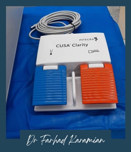 مزایای استفاده ازدستگاه cusa در جراحی‌ها
