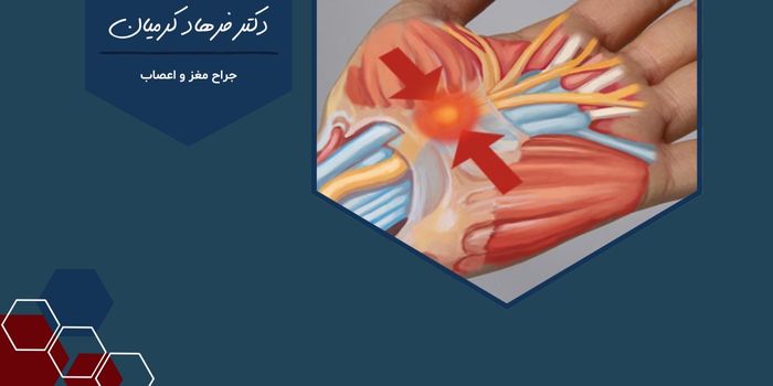 بهترین جراح تنگی کانال عصب دست در مشهد