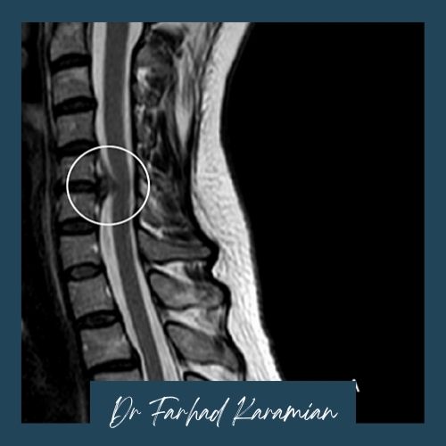 روش‌های تشخیصی دیسک‌