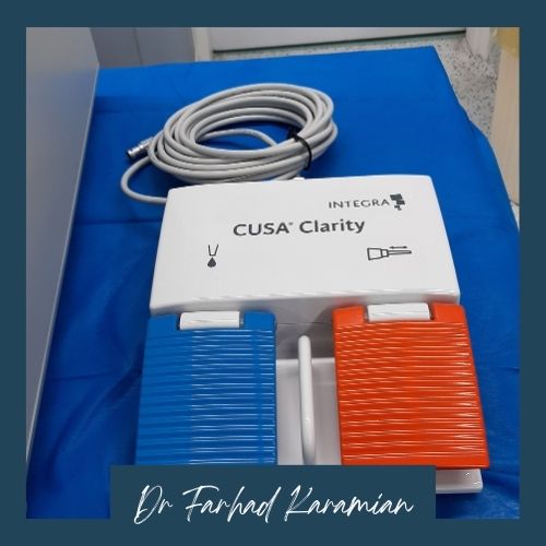 مزایای استفاده ازدستگاه cusa در جراحی‌ها