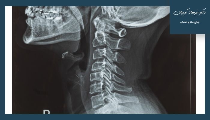 تشخیص آرتروز و دیسک گردن چگونه انجام می‌شود؟ 