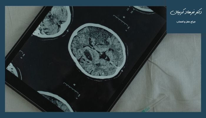 تومور مغزی چطور تشخیص داده میشود؟ تومور مغزی چطور تشخیص داده میشود؟