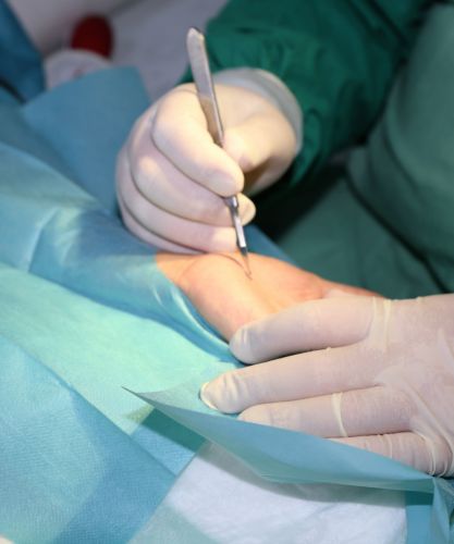 جراحی تنگی کانال عصب مچ دست (cts)