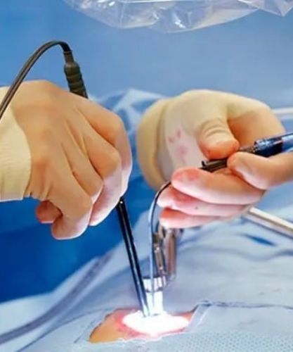 درمان تنگی کانال نخاعی با لیزر درمان تنگی کانال نخاعی با لیزر