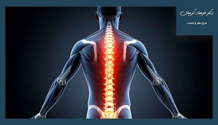 آشنایی با انحراف ستون فقرات آشنایی با انحراف ستون فقرات