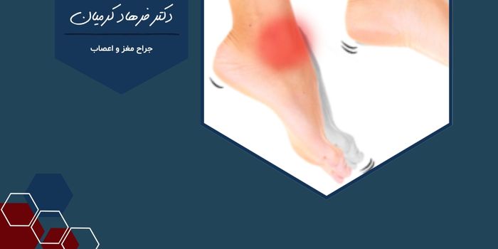 افتادگی مچ پا چه علتی دارد و چگونه درمان می شود؟