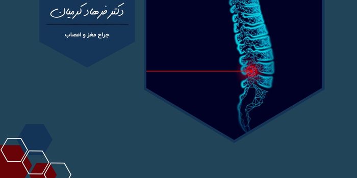 درمان دیسک با لیزر پلاسما در مشهد با بهبودی سریع و بدون جراحی