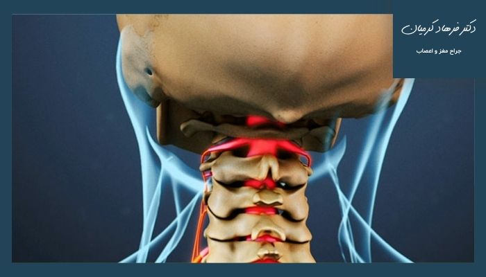 دیسک گردن و نشانه‌های خطرناک آن