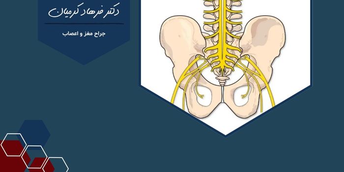 سندروم دم اسبی چیست؟ بررسی علل و راه های درمان آن