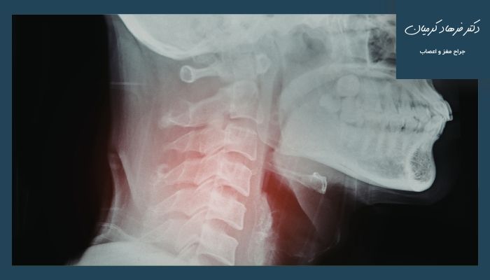 علائم عصبی و هشداردهنده علائم عصبی و هشداردهنده